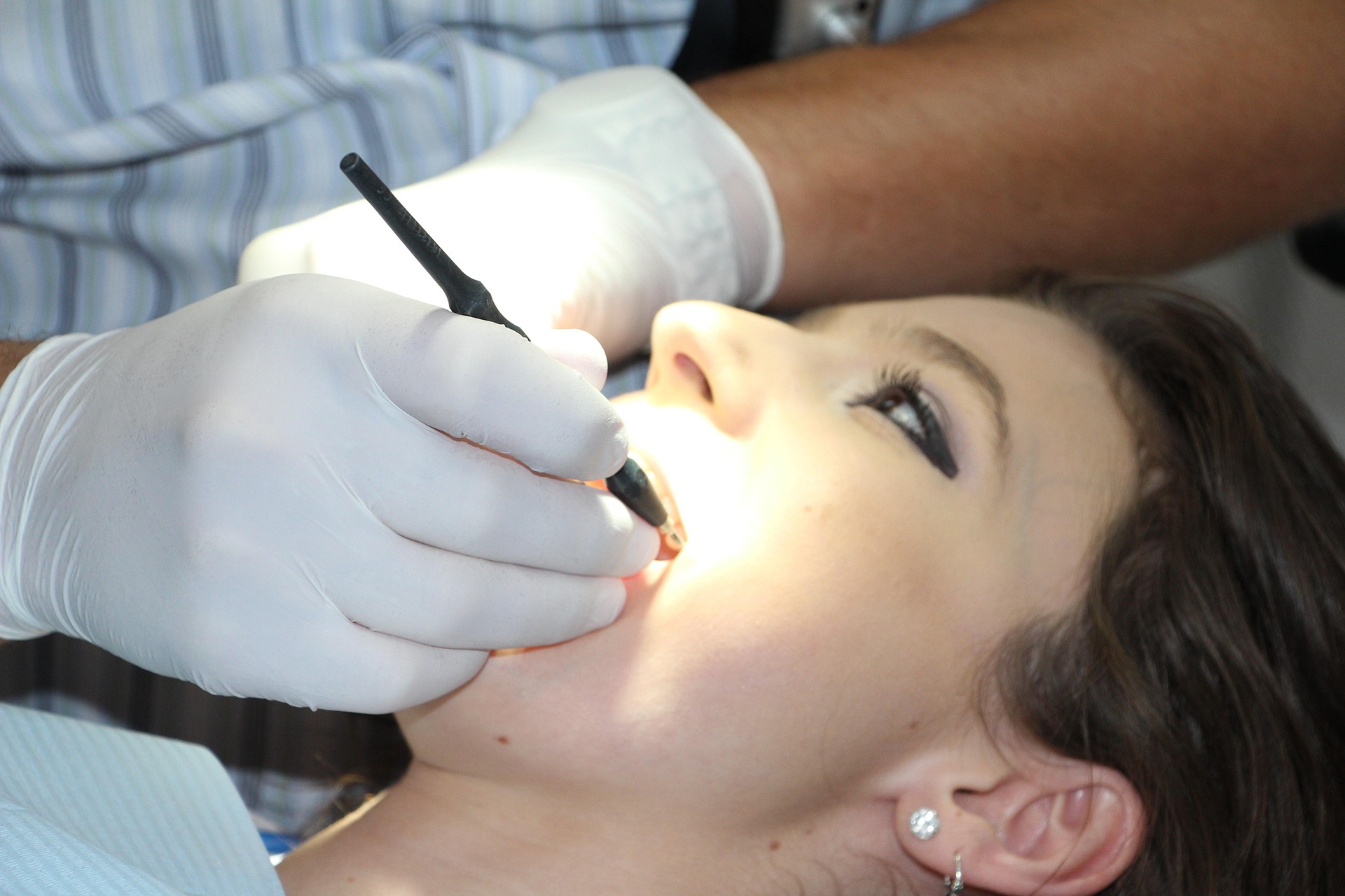 Professional Teeth Cleaning